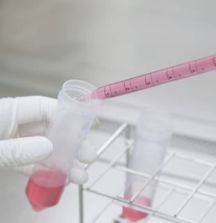 ひざの再生医療(保険外診療)