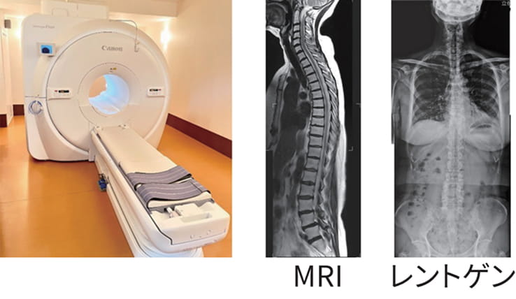 MRI レントゲン