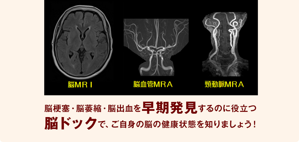 脳MRI・脳血管MRA・頸動脈MRA　脳梗塞・脳萎縮・脳出血を早期発見するのに役立つ脳ドックで、ご自身の脳の健康状態を知りましょう！
